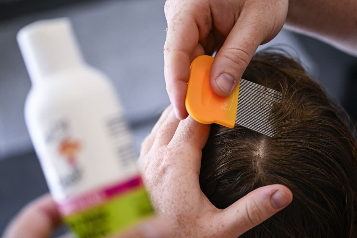 Head lice and nits: 'I'm a health expert here's why head lice is on the ...
