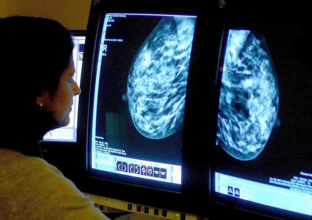 The NHS has a target for 85% of all referrals to start treatment within two months.