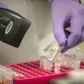 Samples are tested for respiratory viruses during a visit by Chancellor Rishi Sunak to the pathology labs at Leeds General Infirmary. This is the same procedure that will be used by the lab when it begins to receive coronavirus samples for testing. PA Photo.
