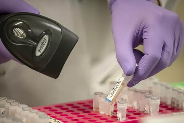 Samples are tested for respiratory viruses during a visit by Chancellor Rishi Sunak to the pathology labs at Leeds General Infirmary. This is the same procedure that will be used by the lab when it begins to receive coronavirus samples for testing. PA Photo.