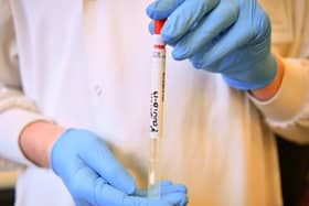 Testing for coronavirus (photo: Ben Birchall / PA Wire).