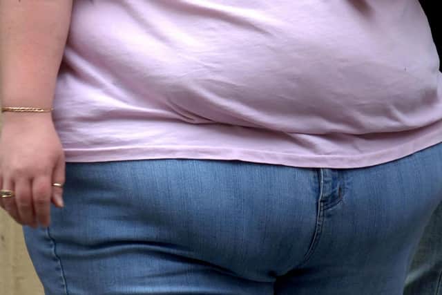 There were 13,085 hospital admissions where obesity was the primary or secondary cause in 2018-19. Photo: PA Images