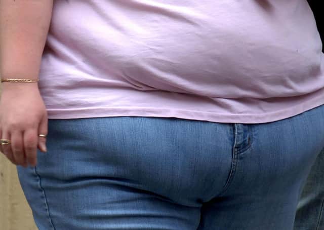 There were 13,085 hospital admissions where obesity was the primary or secondary cause in 2018-19. Photo: PA Images