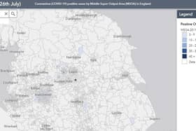 The postcode tool from Public Health England, allows you to see how many cases are in your area as well as the surrounding areas