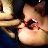 The British Dental Association said patient access across England has “fallen off a cliff” since March. Photo: PA Images