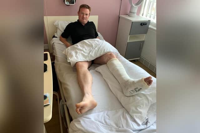 Recovery: TC Minto was taken to hospital and was in a cast for weeks.