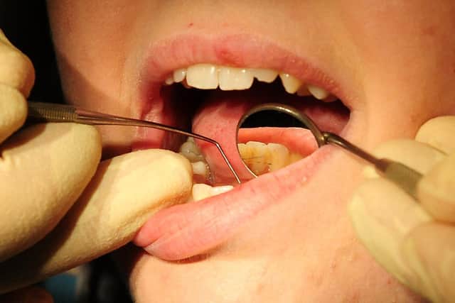 NHS England data shows a steep drop in people visiting the dentist in 2020 and 2021, with millions across England missing check-ups and treatment. Photo: PA Images