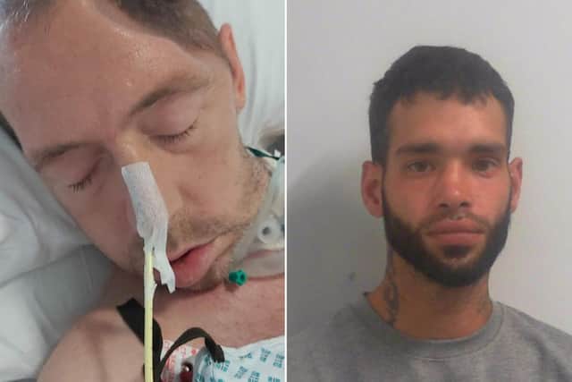Left: Jamie Kelly lost half of his skull while neurosurgeons were treating a bleed on his brain. Right: His attacker, Daniel George Johnson, has been jailed.