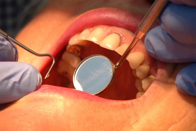 Office for Health Improvement and Disparities figures show that around 10 children aged 19 or younger in the East Riding had at least one tooth removed in hospital due to decay in 2020-21. Photo: PA Images