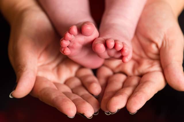 Of the 750 births recorded in the East Riding of Yorkshire in 2020-21 in Office for Health Improvement and Disparities figures, 30.2% were delivered by C-section. Photo: PA Images