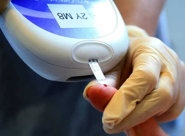 NHS Digital figures show just 29% of 440 type 1 diabetes patients registered with GPs in the NHS East Riding of Yorkshire CCG area received all eight health checks in 2021 – down from 36% in 2019. Photo: PA Images