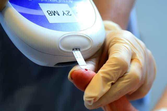 NHS Digital figures show just 29% of 440 type 1 diabetes patients registered with GPs in the NHS East Riding of Yorkshire CCG area received all eight health checks in 2021 – down from 36% in 2019. Photo: PA Images