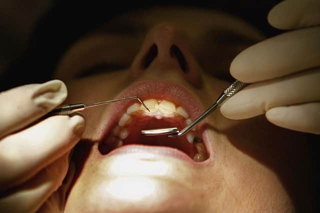 Many patients have reported the negative impact of being unable to access dental care. (Photo: Jeff J Mitchell/Getty Images)