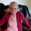 Deborah Bury said she is dealing with pain on a daily basis.