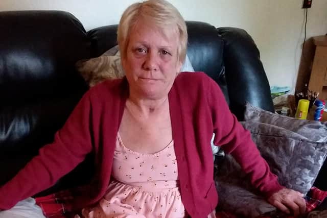 Deborah Bury said she is dealing with pain on a daily basis.