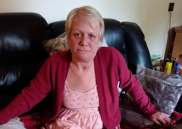 Deborah Bury said she is dealing with pain on a daily basis.