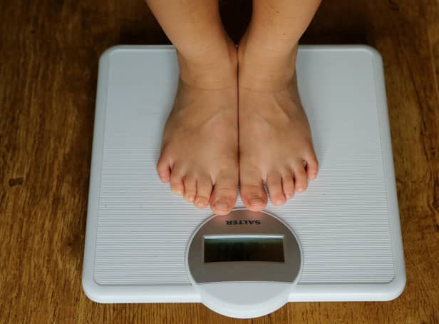 NHS England data shows 146 children and young people began treatment for eating disorders at Humber Teaching NHS Foundation Trust between July 2020 and June 2021. Photo: PA Images