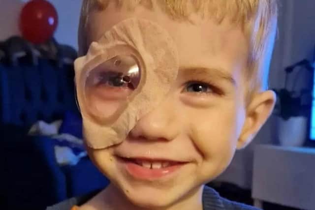 Retinoblastoma patient Harvey during treatment