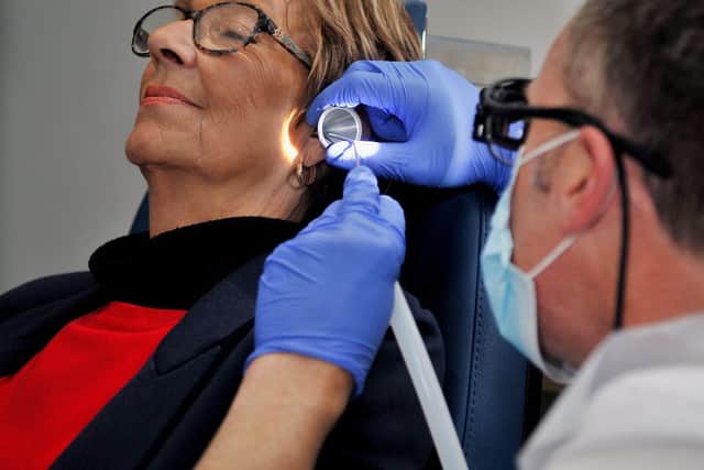 Microsuction wax removal