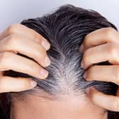 For hair strands to grow grey or white they have to grow out from the root or the follicle. Yet science has now shown that stress can indeed cause the change to be rapid. Photo: AdobeStock
