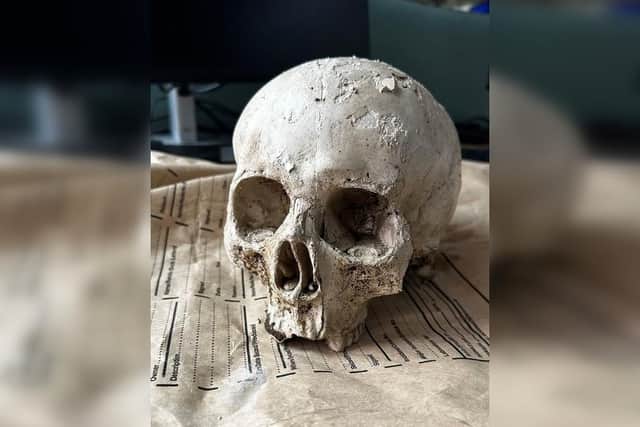 North Yorkshire Police shared an image of the 'human skull'.