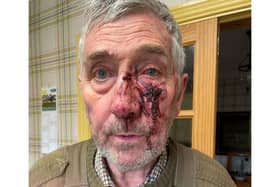 Alan Cummings, was punched to the head and face by one of the men.