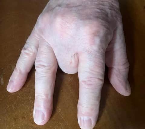 Ask them to place the hand as flat as they can on the table with the thumb and fingers spread out, except for the middle finger (between the forefinger and the ring finger) which should be curled under, with its knuckle resting on the table.