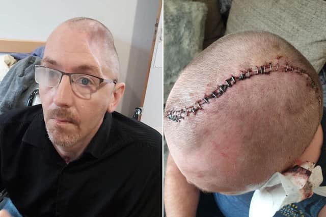 North Yorkshire Police has teamed up with the One Punch UK charity to help prevent tragic deaths and life-changing injuries following the critical injury of one Scarborough man in 2021. (Pics: North Yorkshire Police)