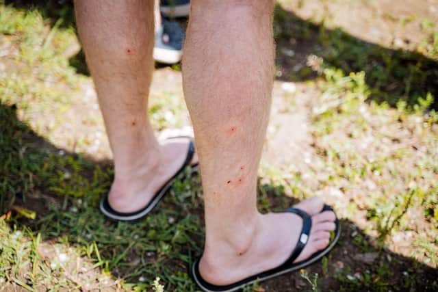 The female of the species is the biter. Photo: AdobeStock