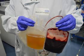 Plasma separated out from red blood cells.