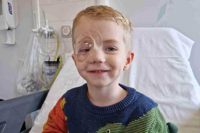 Retinoblastoma patient Harvey during treatment.