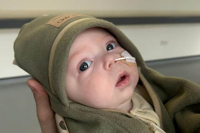Otto Sparkes was diagnosed with Krabbe leukodystrophy in May. Photo courtesy of Ella Burton/SWNS