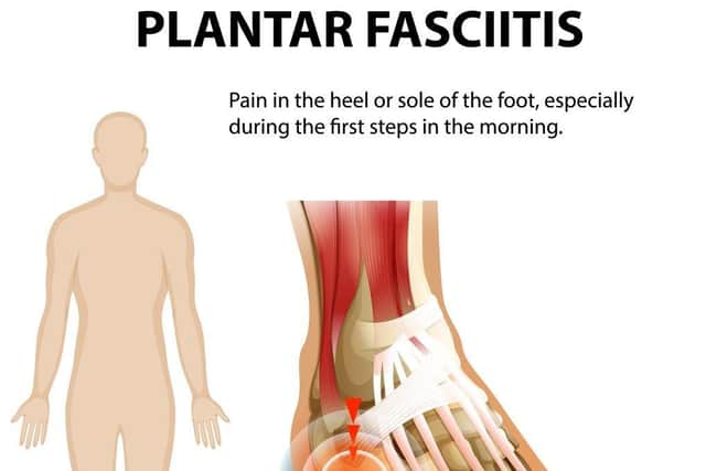 Plantar fasciitis may respond to simple stretch exercises.