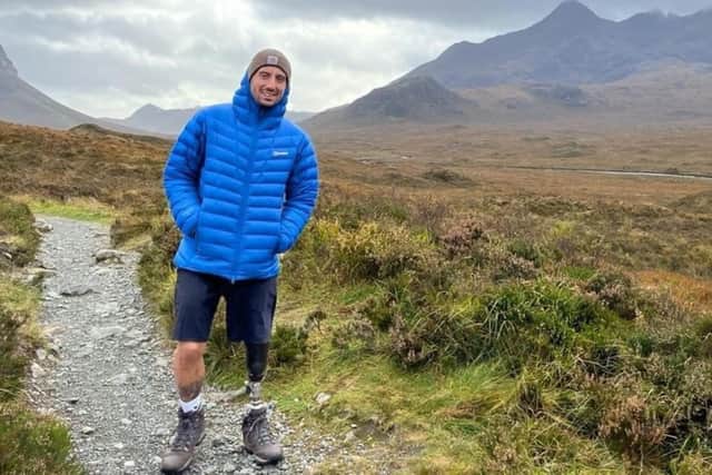 Bridlington man Sam Waddingham had to have his left leg amputated below the knee after suffering horrendous injuries in motorbike crash.