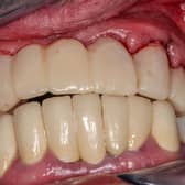 Maintaining good oral health is so important. Photo: StockAdobe
