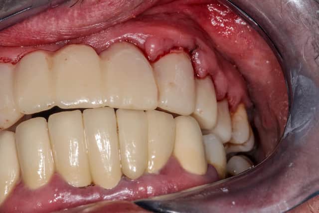 Maintaining good oral health is so important. Photo: StockAdobe