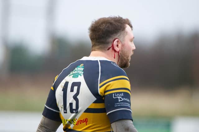 A Bridlington player shows off his wounds