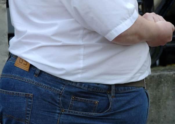 People are going to hospital with obesity-related conditions at record rates in North Yorkshire, figures show.