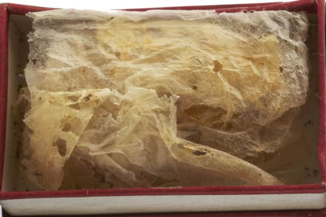 A dried caul purchased in Scarborough as an amulet against death by drowning, 1917.