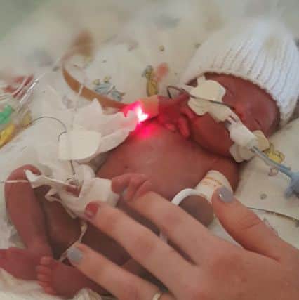 Mayah Iskandar was born 15 weeks premature