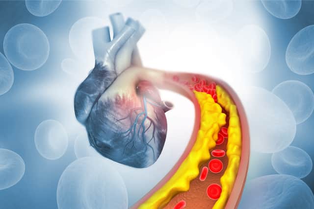 Cholesterol plays an important role in how your body functions (Photo: Shutterstock)